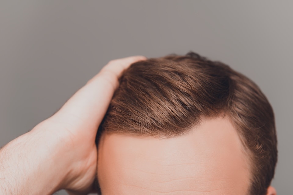 Your hair is not the problem, your scalp is — MoArae scalp-first philosophy